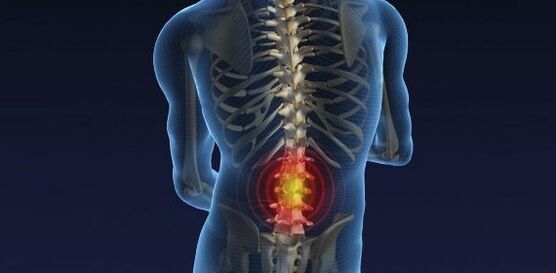 Back pain with lumbar osteochondrosis