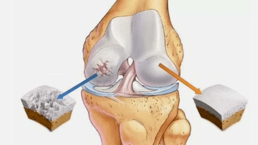How does the joints develop