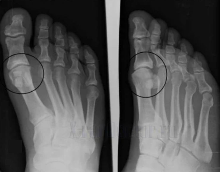 The joint diagnosis