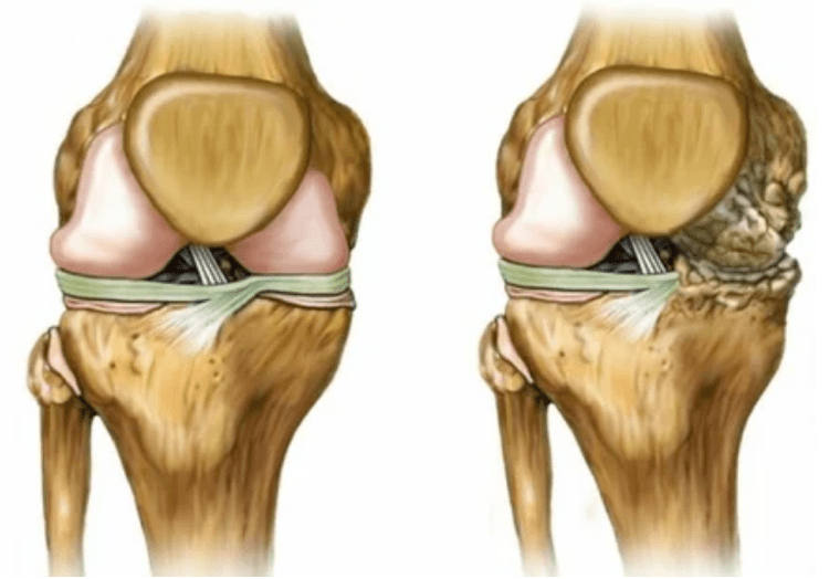 The joint sections