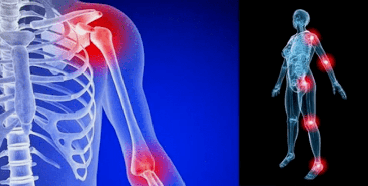 limb deformation from a joint point of view