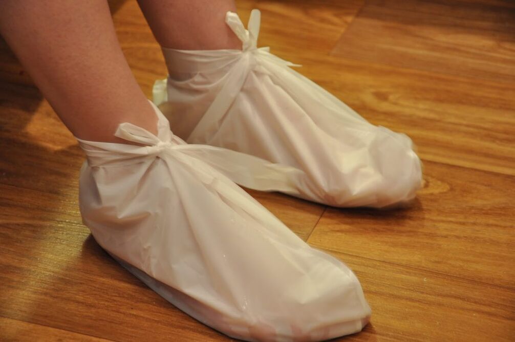 poultice for ankle arthrosis