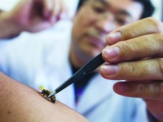 apitherapy for the treatment of cervical osteochondrosis